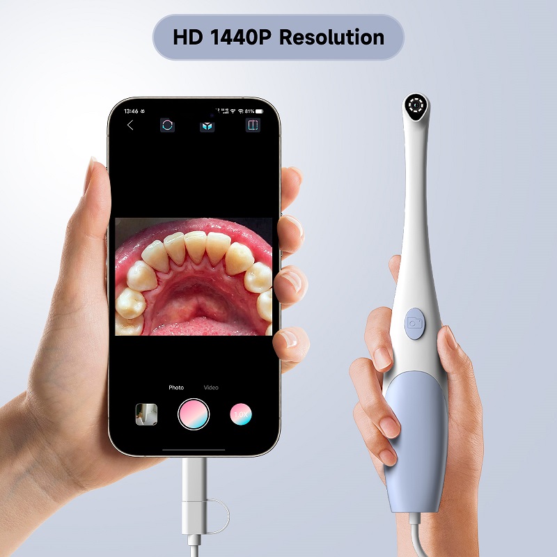 Kamera Endoskop Oral 1440P Fot - Photography Lighting Description ulasan dan harga