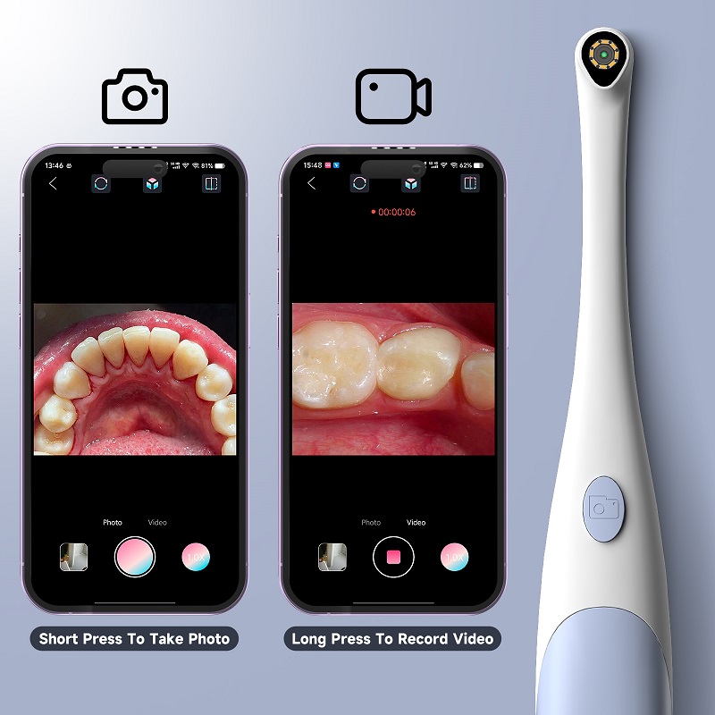 Kamera Endoskop Oral 1440P Fot - Photography Lighting Description ulasan dan harga